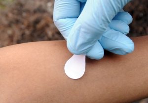 Making vaccine patches easily accessible-FluShotPrices